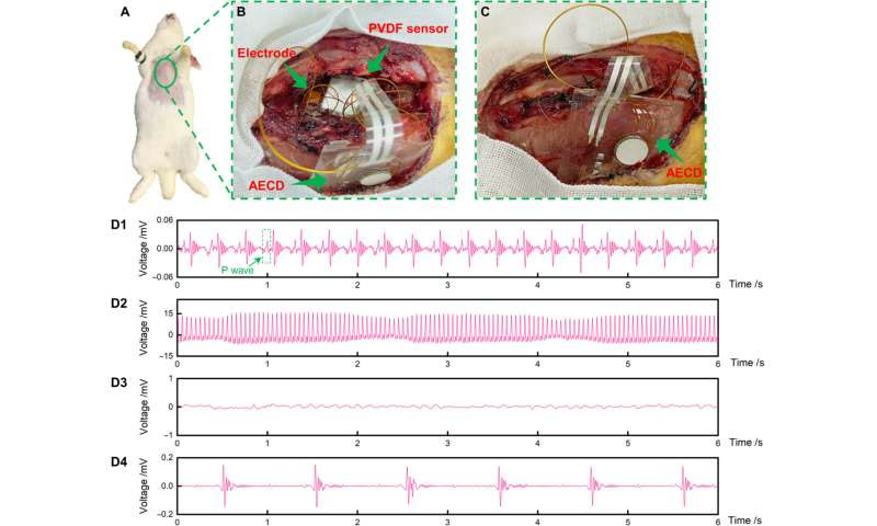 Simultaneous acoustic energy transfer and communication in neuroscience and cardiovascular medicine