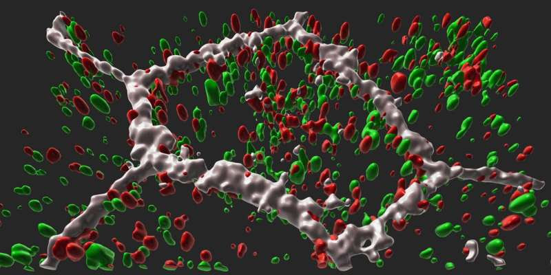 NIH study traces molecular link from gene to late-onset retinal degeneration