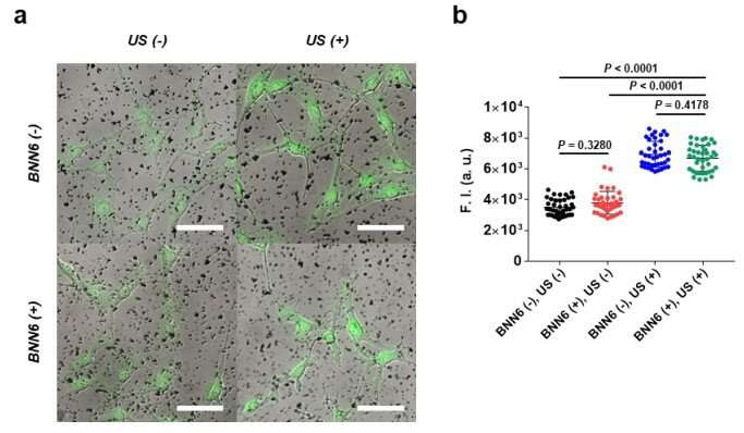 Using piezoelectric nanoparticles to provide deep brain stimulation