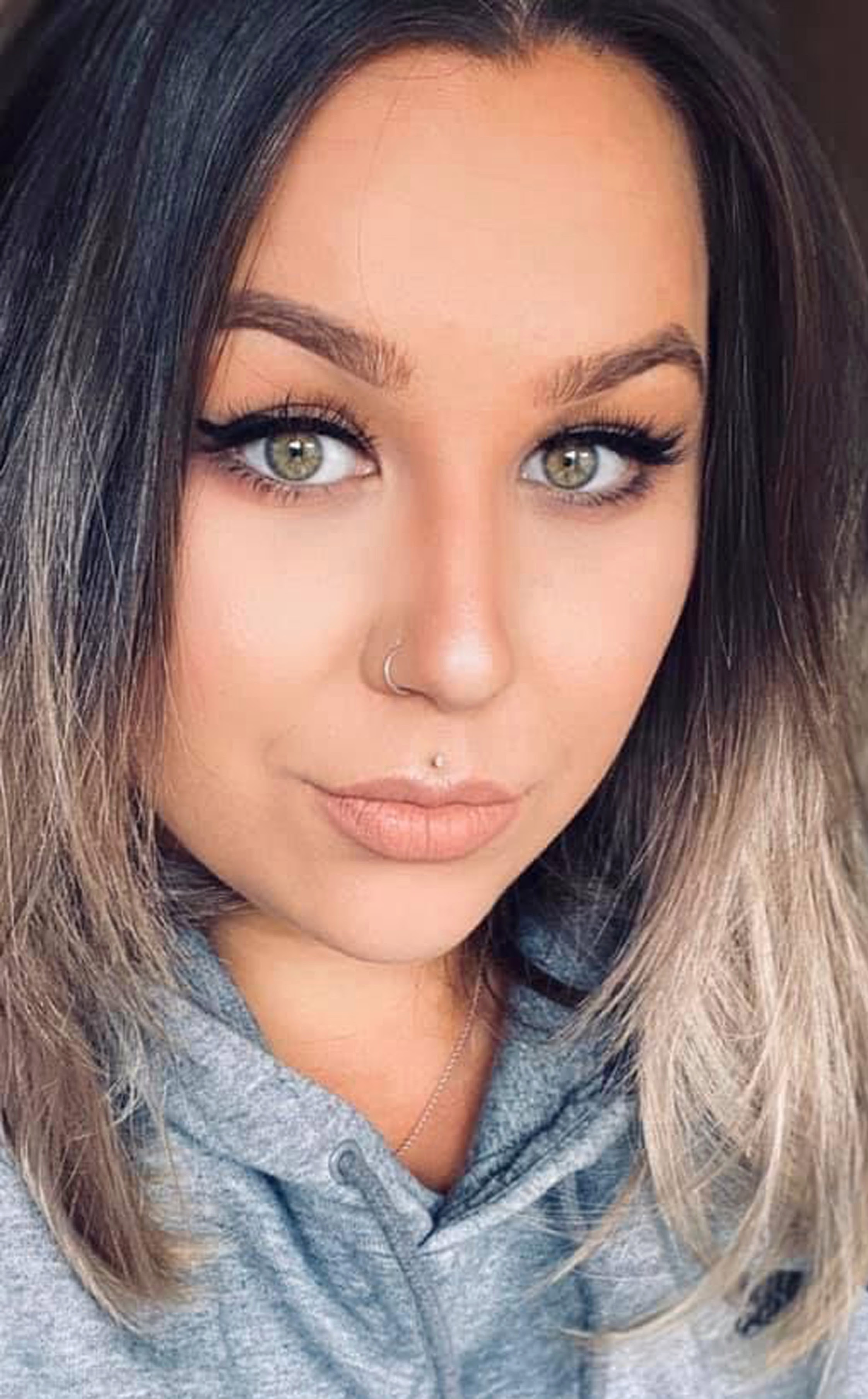Andreea, 26, sente fortes dores menstruais porque tem duas vaginas e dois úteros