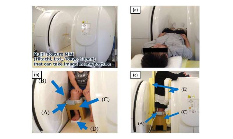 Leg muscle action assists blood flow independently of age