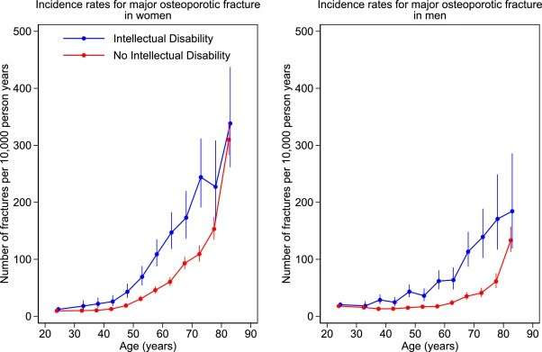 Study shows higher rate of fractures in people with intellectual disability