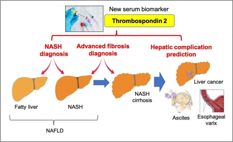 A simple blood test to identify patients at risk of nonalcoholic fatty liver disease