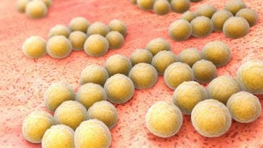 MRSA Infection Bacteria Concept