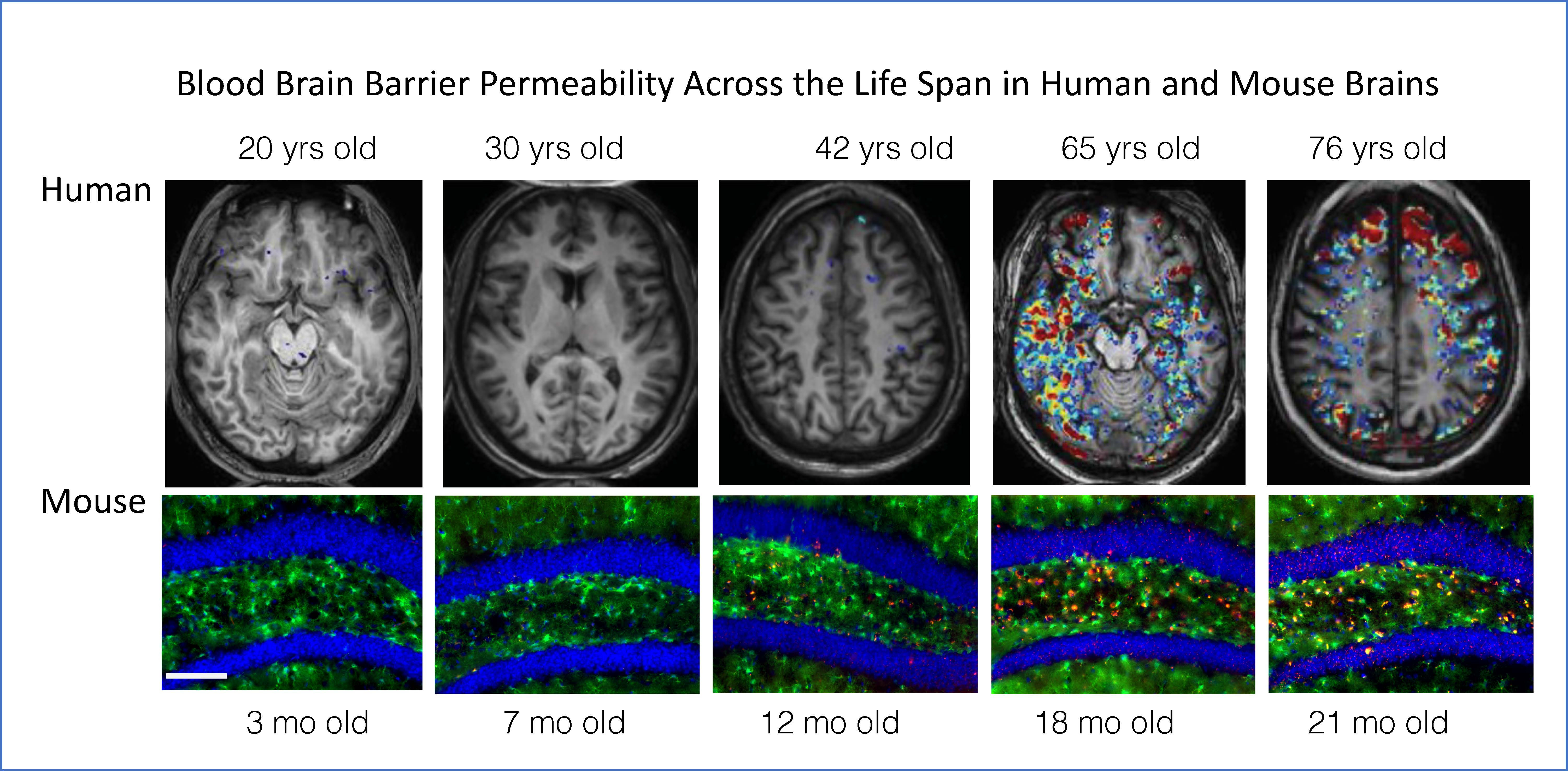 Blood brain barrier paermeability across life span in human and mouse brains
