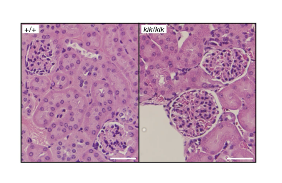 Kidney damage seen in mice with the Y264H mutation to TLR7.