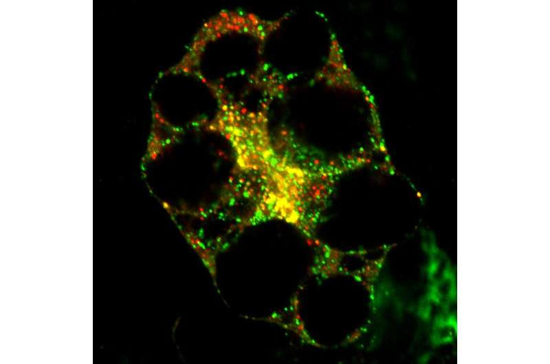 Enhanced autophagy could help treat diabetes