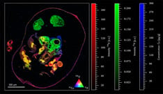 HDIP imaging