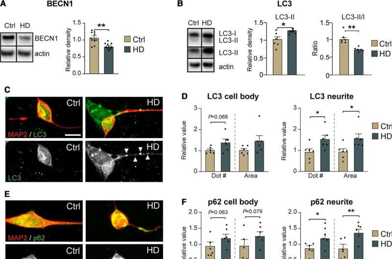 Reprogramming human skin cells into aged neurons to study neurodegenerative disorders