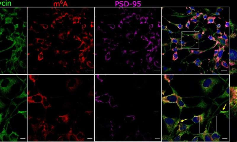 Scientists gain new understanding of how brain cells talk - which could help in the treatment of mental health conditions and me