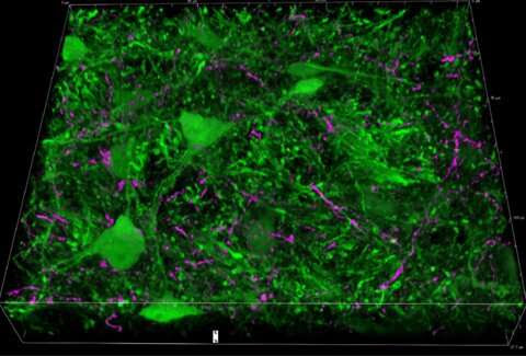 Amygdala found to have role in important pre-attentive mechanism in the brain