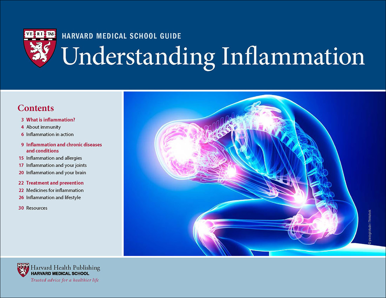 Understanding Inflammation