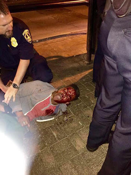 Martese Johnson-racismo-eeuu