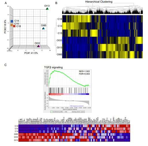 Targeting TGF-β for treatment of osteogenesis imperfecta