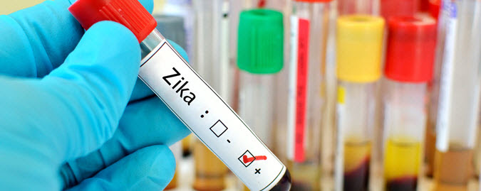 blood test with the word Zika on blood sample