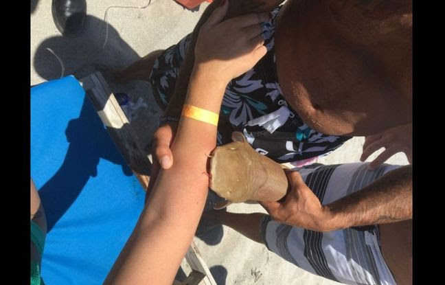Attaquée par un requin, la jeune femme de 23 ans a été transportée à l'hôpital avec le squale encore planté dans son bras.