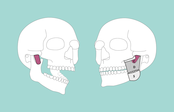 New muscle layer discovered on the jaw