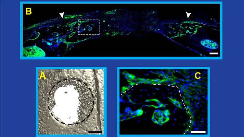 Study shows nervous and immune systems ‘need to talk’ for bone repair