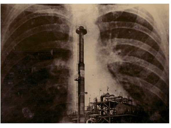 FABRICA Y PULMONES