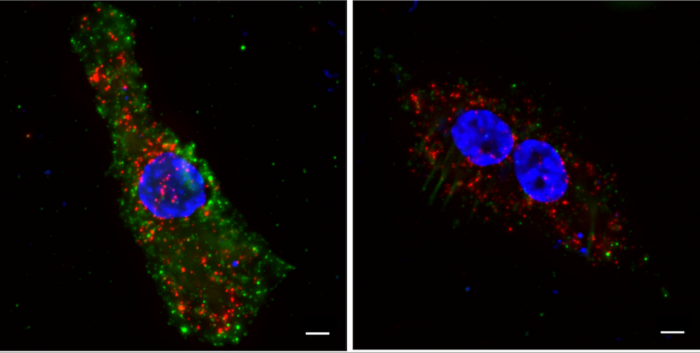 Innate Immune Response Against HIV