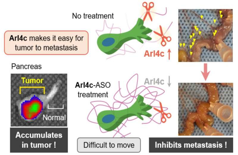 Researchers discover why pancreatic cancer cells are so aggressive