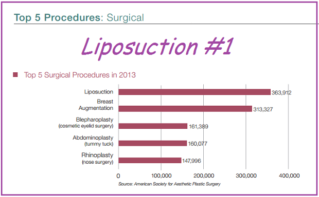 Liposuction