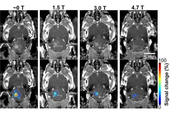 MRI’s magnetic field affects focused ultrasound technology