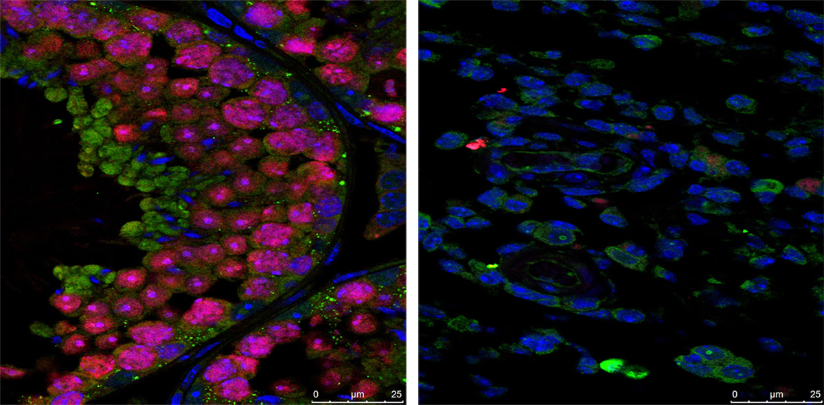 Immunofluorescence staining showing that the testes of Zika-free mice (left) are full of developing sperm (pink), while the testes of Zika-infected mice (right) contain very few sperm.
