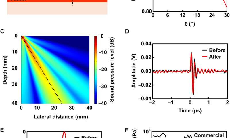 Monitoring blood flow velocity with a flexible Doppler Ultrasound device