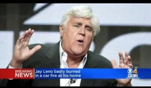 TV Icon Jay Leno Goes Up In Flames During Frightening Accident