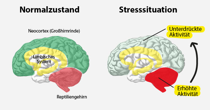 https://www.habitgym.de/wp-content/uploads/2017/05/Stressfaktoren-Das-Gehirn-im-Stress.jpg