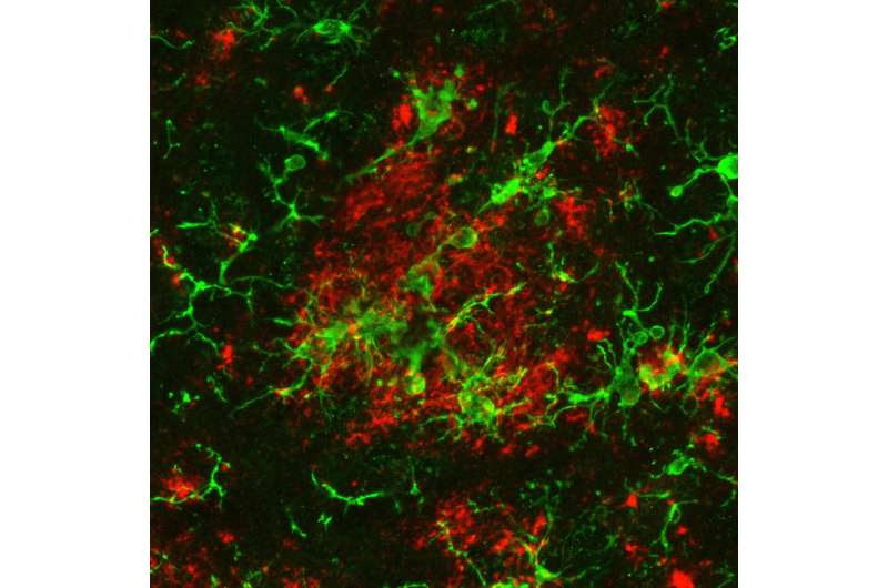 Study shows new way to spur brain immune cells to clear toxic waste linked to Alzheimer's disease