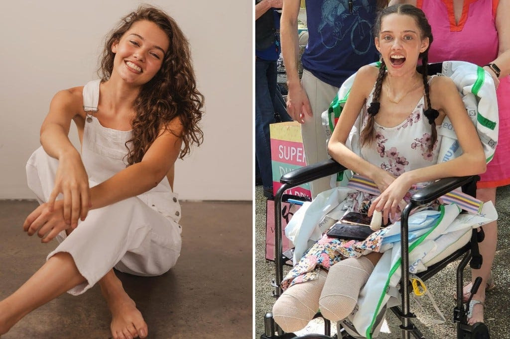 Claire Bridges, 20, had both her legs amputated after suffering complications from COVID-19. The Florida-based model was released from hospital last Thursday following a two-month stay.
