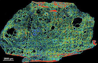 Using QCLs for MIR-Based Spectral Imaging — Applications in Tissue Pathology