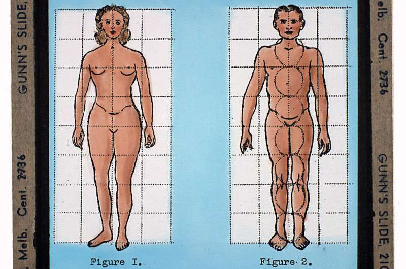 DNA sites linked with physical differences between sexes now also linked to disease risk