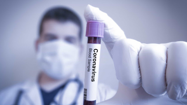 Letalidade da Covid-19 é semelhante à da pneumonia, calcula estudo