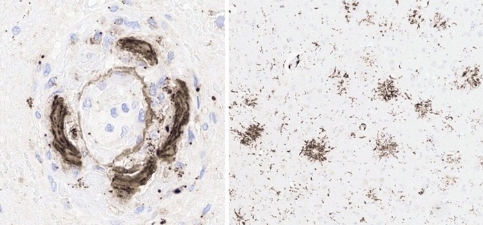 Most striking findings - mononuclear attack