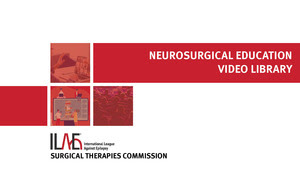 neurosurgery
                          video playlist page