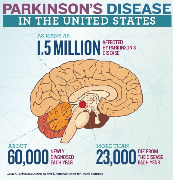 Surgeons from China have planned a new Parkinson treatment with stem cells. The first step to treat this diseases with this technique.