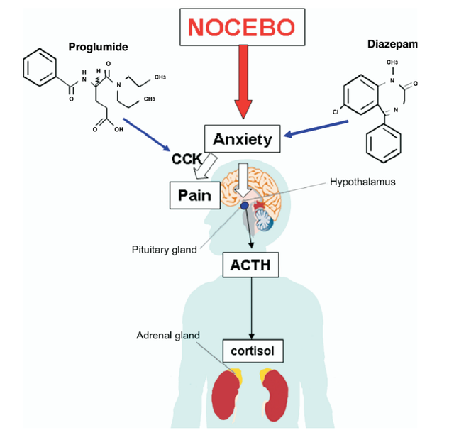 Nocebo: Hiệu ứng kỳ lạ sau khi tiêm vắc-xin COVID-19 - Ảnh 3.