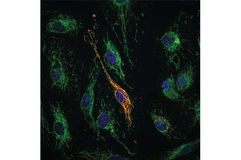 Newly-discovered molecule provides dual protection against vascular inflammation