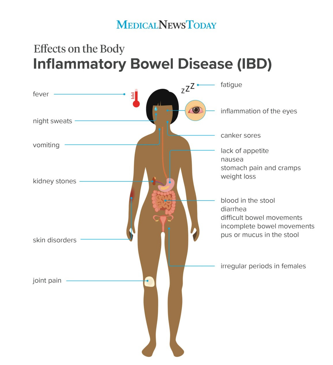 an infographic showing the effect on the body of IBD