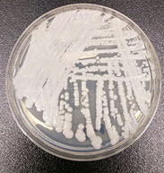A strain of C. auris cultured in a petri dish