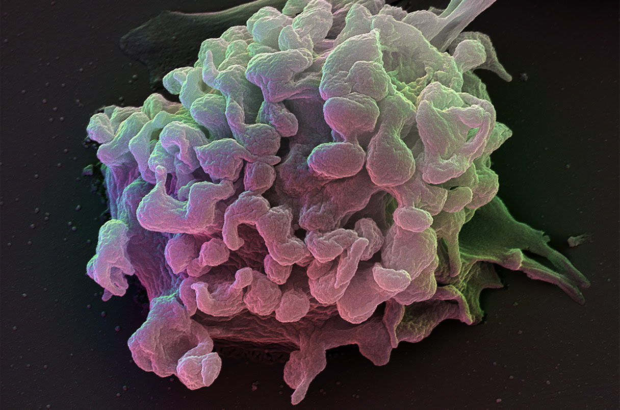 Colorized scanning electron micrograph of a T cell