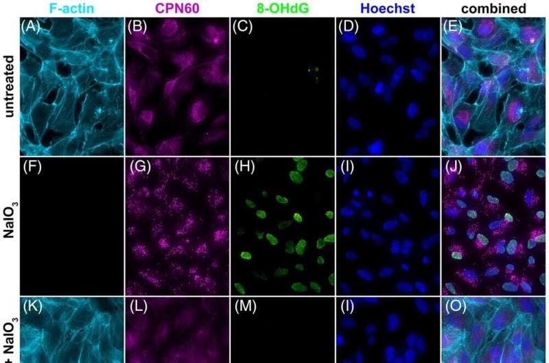 New gene therapy shows promise for treating age related macular degeneration