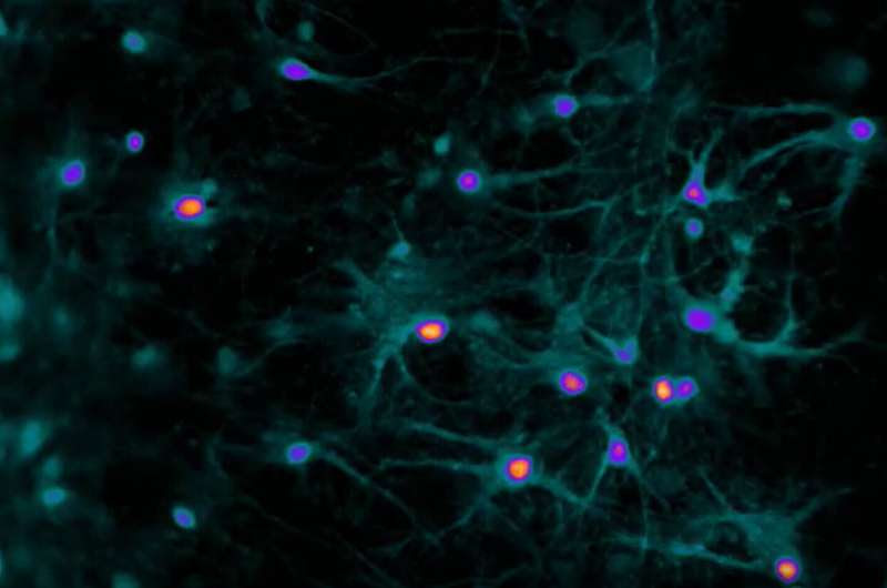 Scientists elucidate how chemogenetic technology highjacks neuronal activity