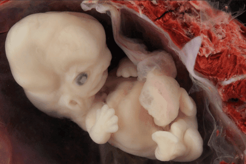 6-7-week-embryo-LMP-8-9-weeks