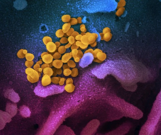 imagen del virus que causa la enfermedad por coronavirus COVID-19 al microscopio