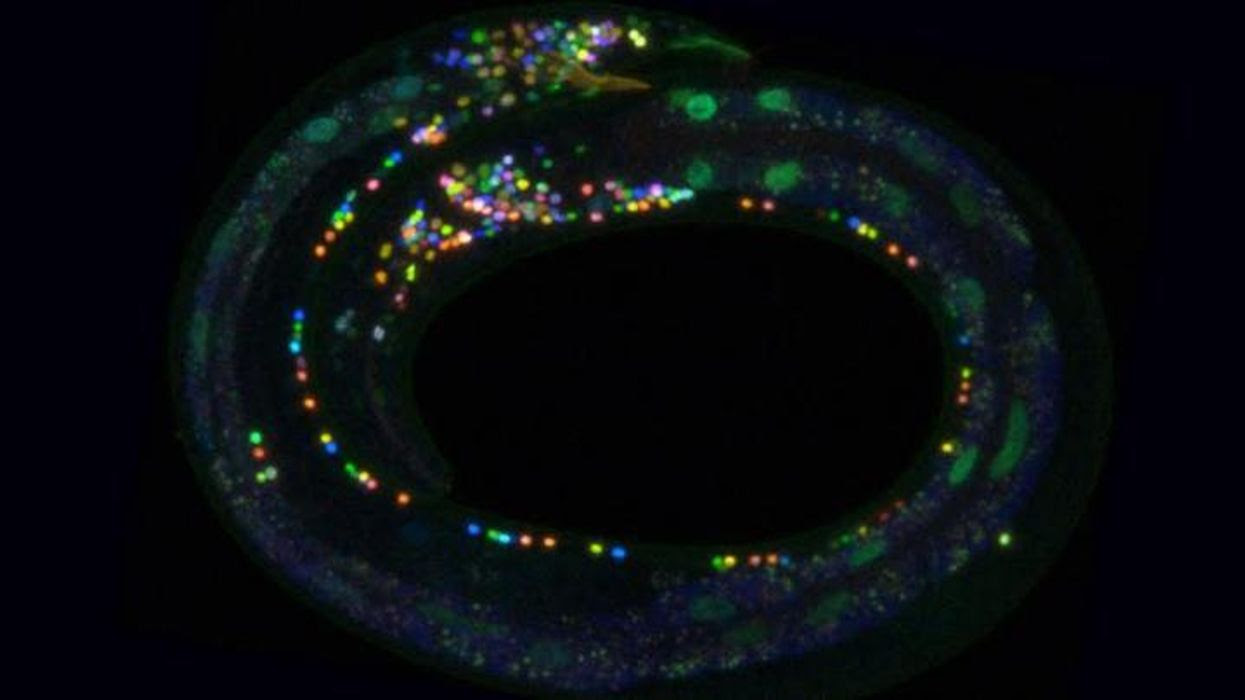 Colorful brain mapping tool lights up neural connections  5c24e0a9-c09e-4a71-ab57-667bb6f0fac7