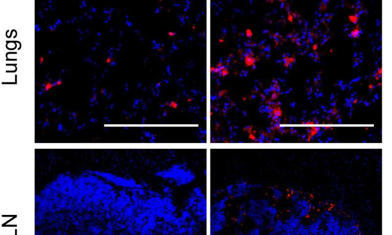 Delivering vaccines directly to the lungs can boost immune responses to respiratory infections or lung cancer: study